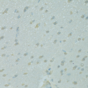 Anti-NCOA2 Antibody [KO Validated] (CAB10280)