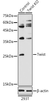 Anti-Twist Antibody [KO Validated] (CAB15596)