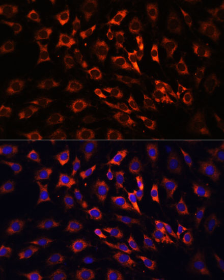 Anti-ERK1 / ERK2 Antibody (CAB16686)