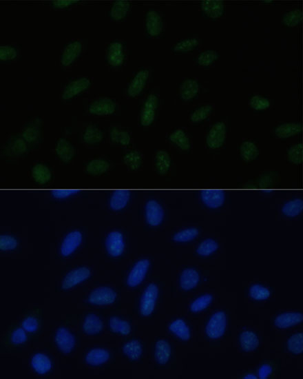 Anti-PELP1 Antibody (CAB3189)