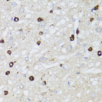 Anti-MIP Antibody (CAB2886)