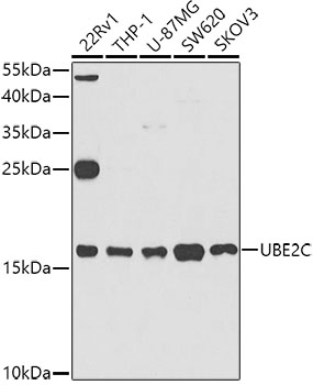 Anti-UBE2C Antibody (CAB5499)