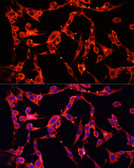 Anti-AOC1 Antibody (CAB6249)