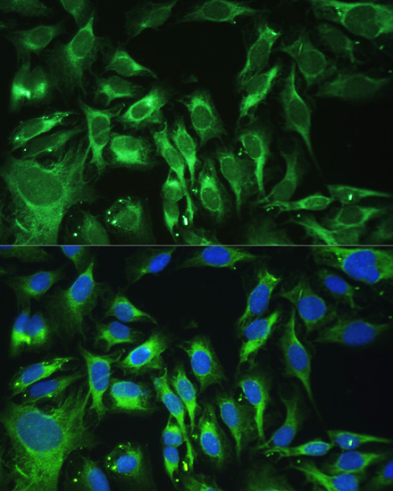 Anti-OGN Antibody (CAB6679)