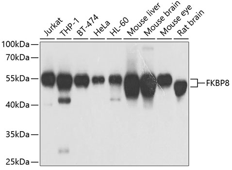 Anti-FKBP8 Antibody (CAB7085)