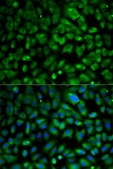 Anti-EIF4E Antibody (CAB0468)