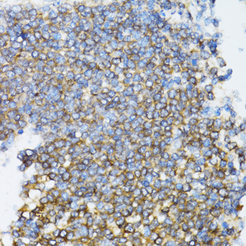 Anti-UBE2D1 Antibody (CAB1951)