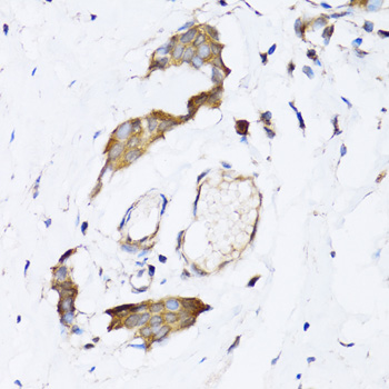 Anti-NAA10 Antibody (CAB7009)