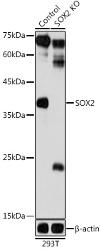 Anti-SOX2 Antibody [KO Validated] (CAB0561)