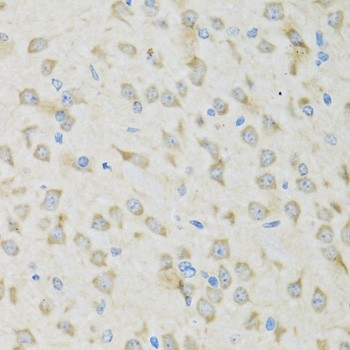 Anti-CLCN7 Antibody (CAB6886)