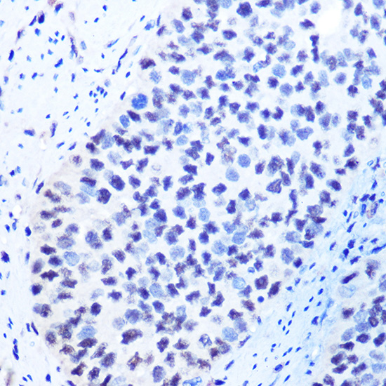 Anti-METTL3 Polyclonal Antibody (CAB8370)