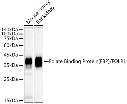 Western blot analysis of extracts of various cell lines, using Folate Binding Protein(FBP) / FOLR1 antibody at 1:1000 dilution. Secondary antibody: HRP Goat Anti-Rabbit IgG (H+L) at 1:10000 dilution. Lysates/proteins: 25ug per lane. Blocking buffer: 3% nonfat dry milk in TBST. Detection: ECL Basic Kit. Exposure time: 90s.