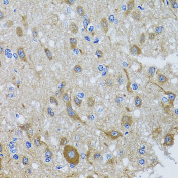 Anti-DYNC1I1 Antibody (CAB3833)