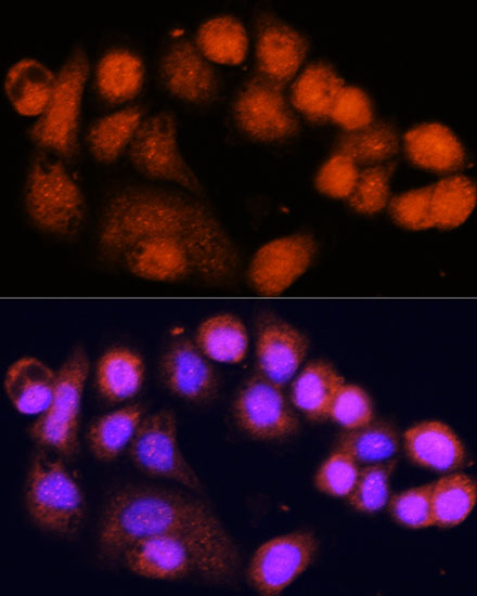 Anti-MSH4 Polyclonal Antibody (CAB8556)