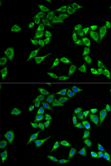 Anti-PHLDA2 Antibody (CAB6244)