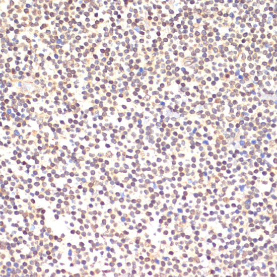 Anti-TIA1 Antibody (CAB12517)