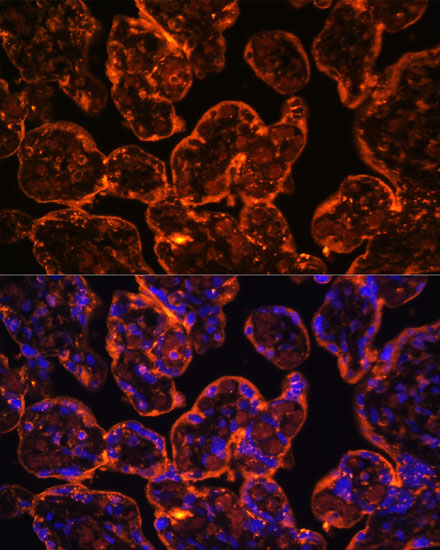 Anti-ENTPD1/CD39 Antibody (CAB3778)