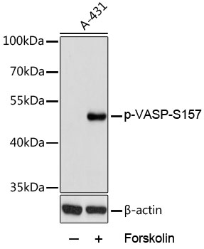 Anti-Phospho-VASP-S157 pAb (CABP0763)