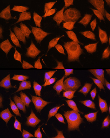 Anti-Bax Antibody (CAB15646)