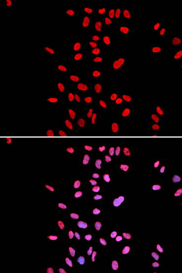 Anti-DKC1 Antibody (CAB1862)