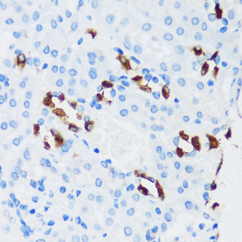 Anti-ATP6V1G3 Antibody (CAB14443)