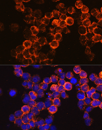 Anti-PTPRC Antibody (CAB2115)