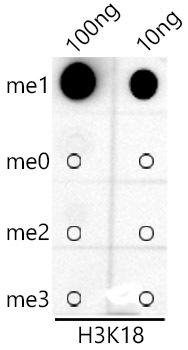 Immunohistochemistry of paraffin-embedded human breast cancer using MonoMethyl-Histone H3-K18 Rabbit mAb at dilution of 1:100 (40x lens). Perform high pressure antigen retrieval with 10 mM citrate buffer pH 6. 0 before commencing with IHC staining protocol.