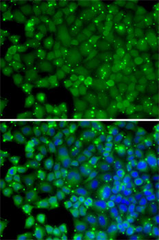 Anti-ARRB2 Antibody (CAB13278)