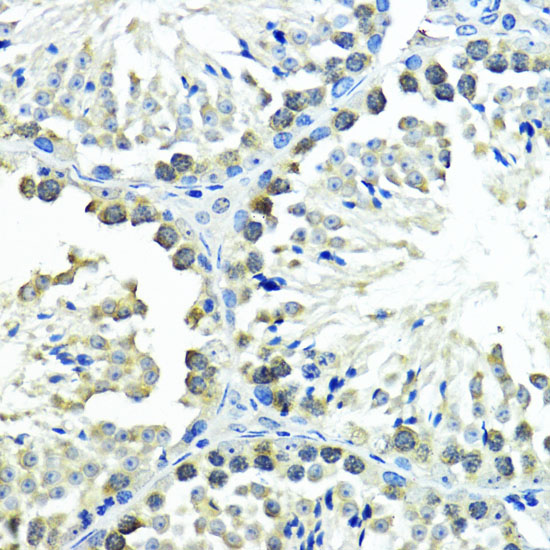 Anti-SUMO1 Antibody (CAB2130)