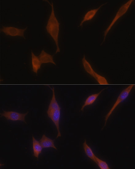 Anti-MLPH Antibody (CAB6656)