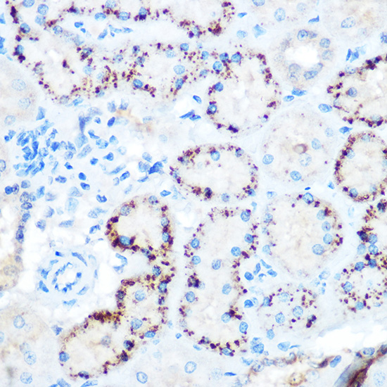 Anti-ANGPTL4 Antibody (CAB2011)