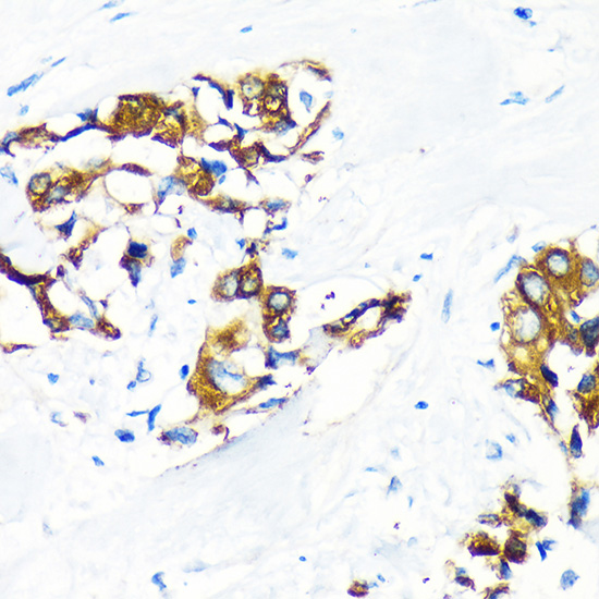 Anti-AGR2 Antibody (CAB7064)