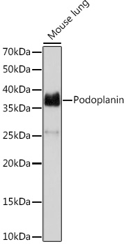 Anti-Podoplanin Antibody (CAB9242)