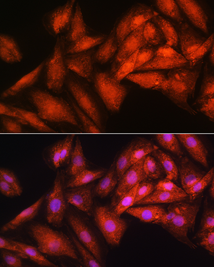 Anti-EXOSC2 Antibody (CAB10450)