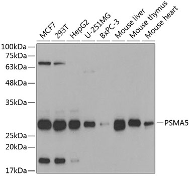 Anti-PSMA5 Antibody (CAB5752)