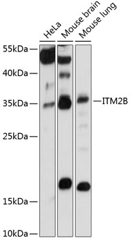 Anti-ITM2B Antibody (CAB14824)