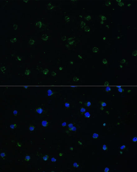 Anti-ARHGAP25 Antibody (CAB1223)