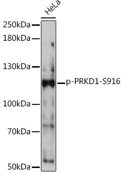 Anti-Phospho-PRKD1-S916 Antibody (CABP1097)