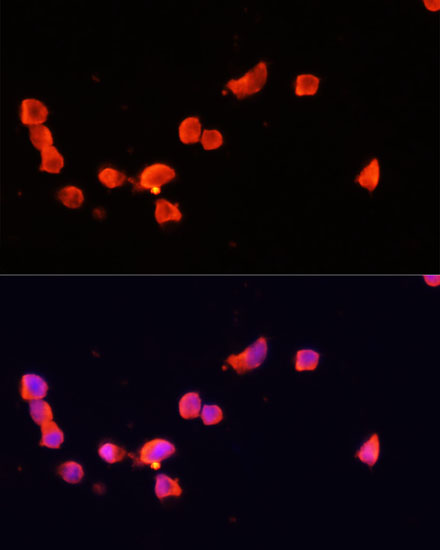 Anti-CDK5R1 Antibody (CAB14497)