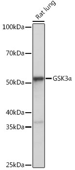 Anti-GSK3Alpha Antibody [KO Validated] (CAB19060)