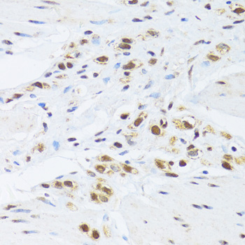 Anti-GABPB1 Antibody (CAB6909)