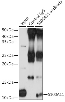Anti-S100A11 Antibody [KO Validated] (CAB5486)