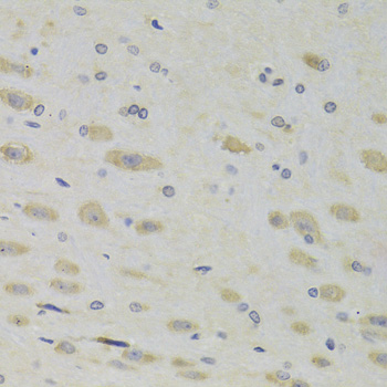 Anti-RPL9 Antibody (CAB13632)