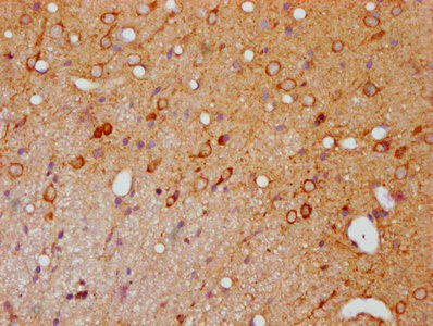 Anti-Phospho-PAK1/PAK2/PAK3 recombinant antibody (RACO0069) product image from Assay Genie