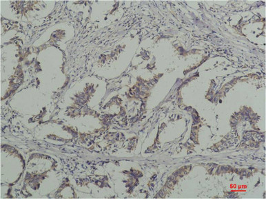 Anti-Phosphotyrosine Antibody