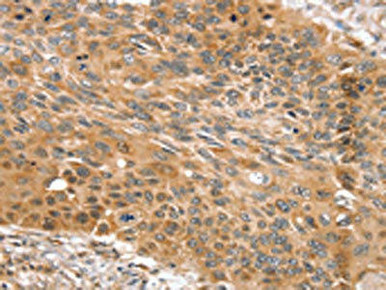 Anti-SNX11 Antibody (PACO17136) | WB, IHC