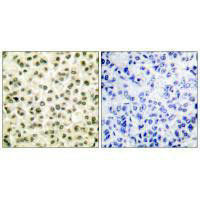 XRCC6/XRCC5 Antibody PACO23829