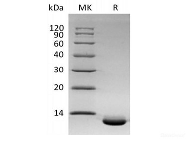 Recombinant Human C-X-C Motif Chemokine 6/CXCL6 (C-6His) | Assay Genie