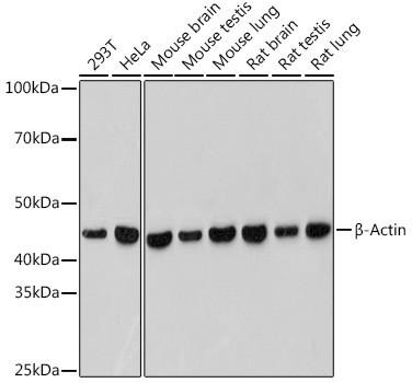 β-Actin Rabbit Monoclonal (CABC038)