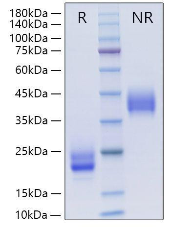 Recombinant Mouse CSF-1/M-CSF Protein (RPCB0002)